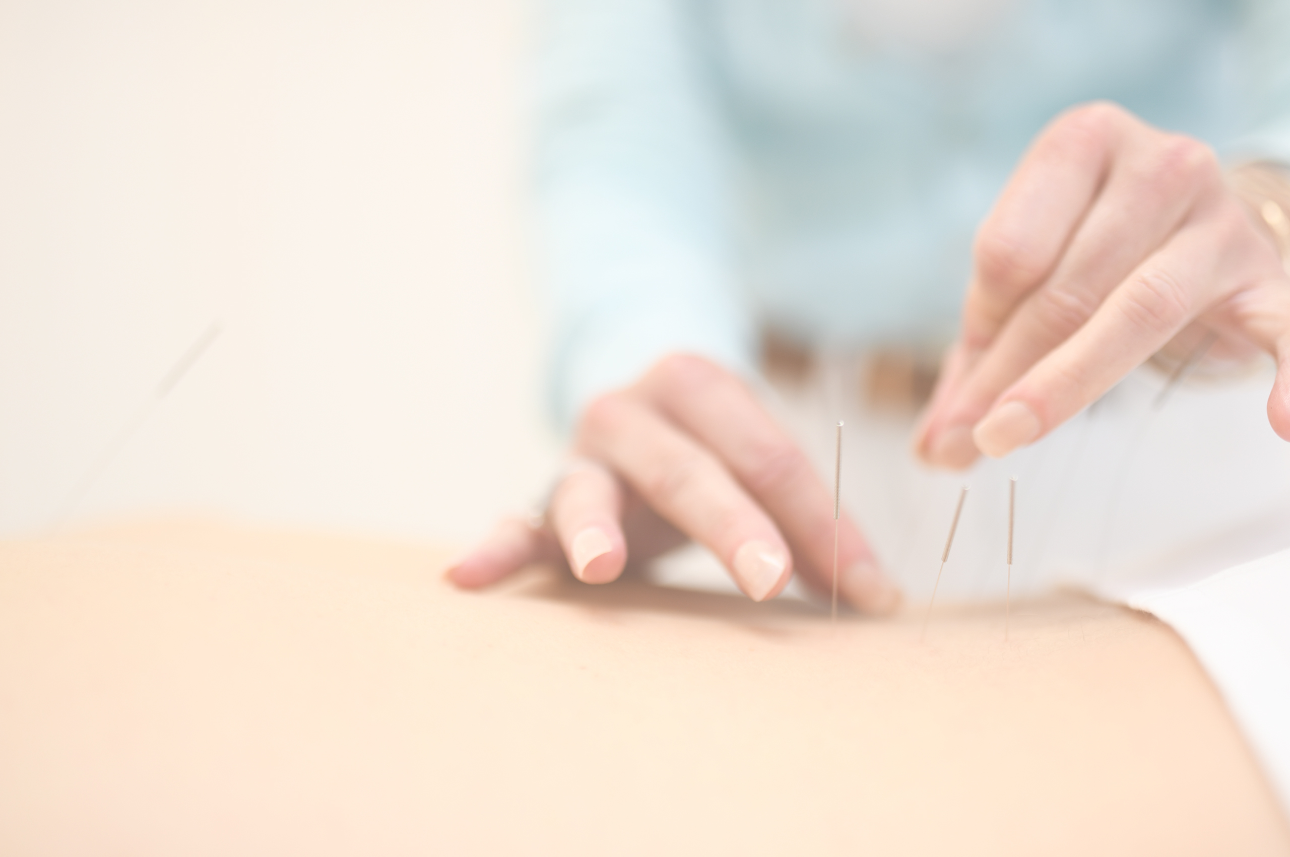 acupuncture The Yin Clinic